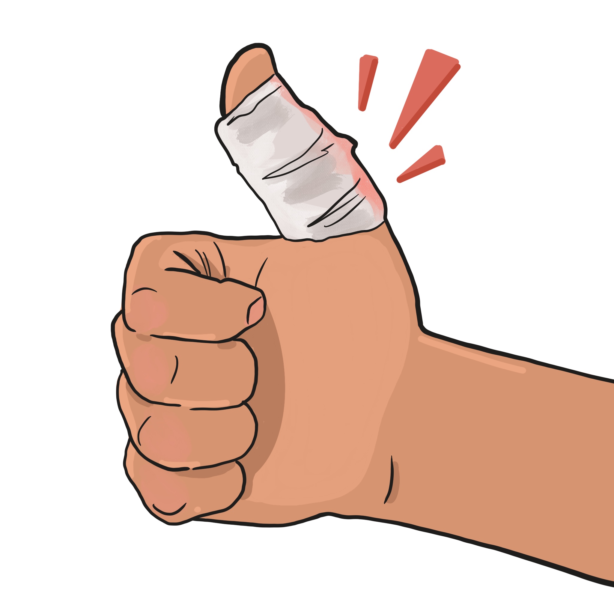 How to Recover from a Sprained Thumb