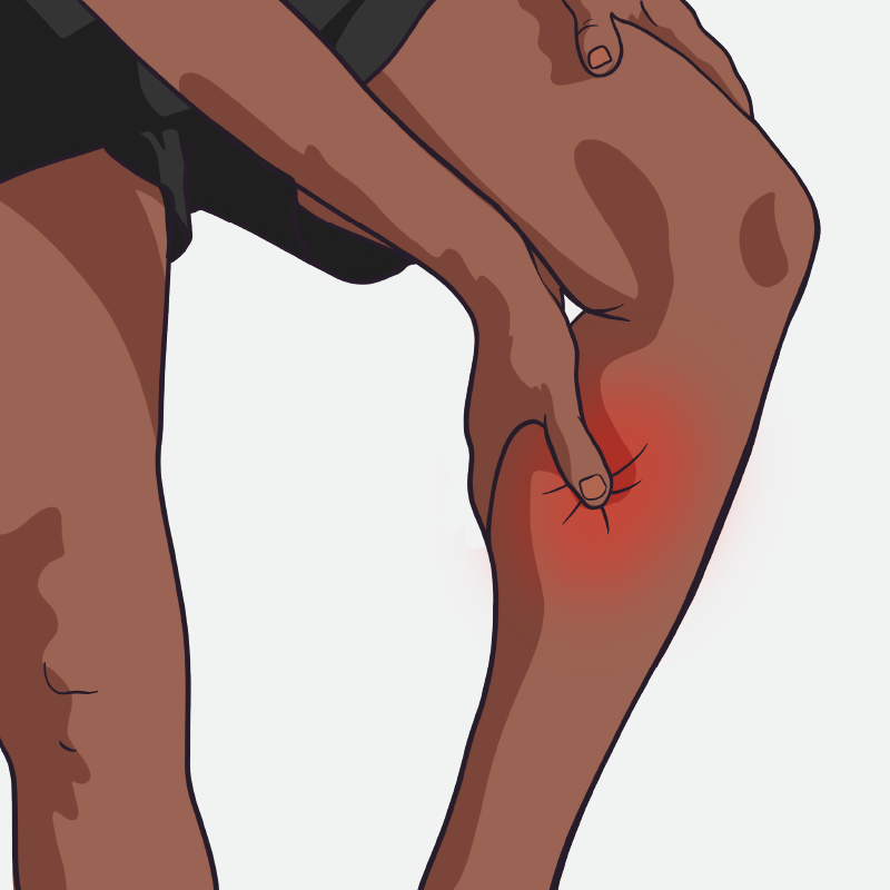 How to Recover from a Pulled Calf Injury