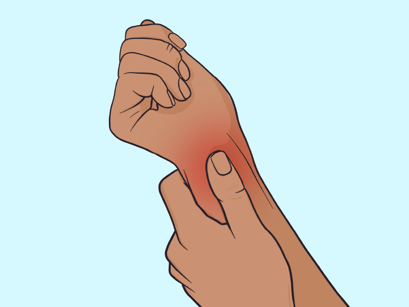 How to Recover from a Sprained Wrist